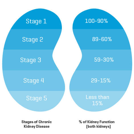 Graphic showing the different stages of CKD and declining kidney function